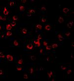 TLR11 Antibody in Immunocytochemistry (ICC/IF)