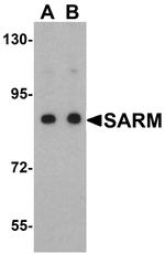 SARM Polyclonal Antibody