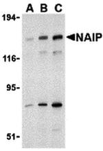 NAIP Antibody in Western Blot (WB)