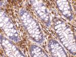 HTRA2 Polyclonal Antibody