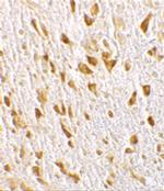 CENTG1 Polyclonal Antibody