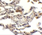 cIAP1 Polyclonal Antibody