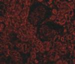 Bcl-2 Polyclonal Antibody