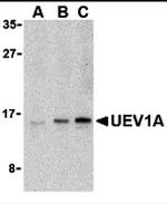 UBE2V1 Polyclonal Antibody