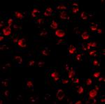 Bim Antibody in Immunocytochemistry (ICC/IF)