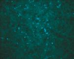 West Nile Virus Core Antigen Polyclonal Antibody