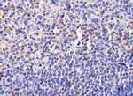 Caspase 1 Antibody in Immunohistochemistry (IHC)
