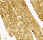 Caspase 7 Polyclonal Antibody