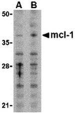 MCL-1 Antibody in Western Blot (WB)