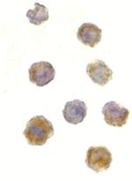 mTOR Polyclonal Antibody