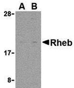 RHEB Polyclonal Antibody