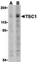 TSC1 Polyclonal Antibody