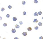 TSC2 Polyclonal Antibody