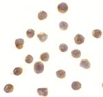 RSK1 Antibody in Immunocytochemistry (ICC/IF)