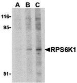 RSK1 Antibody in Western Blot (WB)