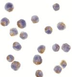 IRS1 Polyclonal Antibody