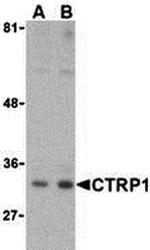 CTRP1 Polyclonal Antibody