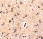 CTRP2 Polyclonal Antibody