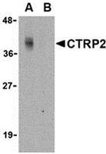 CTRP2 Polyclonal Antibody