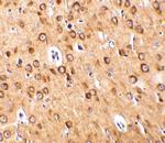 CTRP4 Antibody in Immunohistochemistry (IHC)