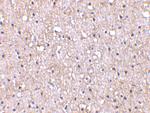 CTRP5 Polyclonal Antibody