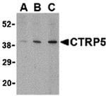 CTRP5 Polyclonal Antibody