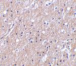 CTRP6 Antibody in Immunohistochemistry (IHC)