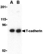 H-cadherin Antibody in Western Blot (WB)