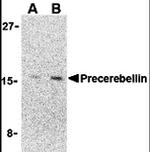 Precerebellin Antibody in Western Blot (WB)