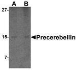 Precerebellin Antibody in Western Blot (WB)