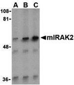 IRAK2 Polyclonal Antibody