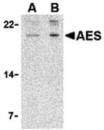 AES Antibody in Western Blot (WB)
