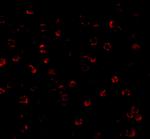 ATG7 Antibody in Immunocytochemistry (ICC/IF)