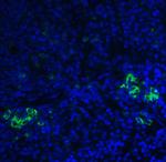TLR3 Polyclonal Antibody
