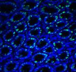 IRE1 alpha Antibody in Immunohistochemistry (PFA fixed) (IHC (PFA))