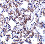 BAP31 Polyclonal Antibody