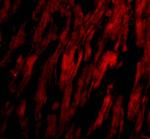 BAP29 Polyclonal Antibody