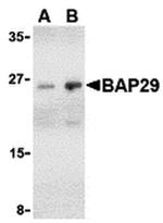 BAP29 Polyclonal Antibody
