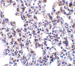 BAP31 Polyclonal Antibody