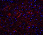 Apolipoprotein J Antibody in Immunohistochemistry (IHC)