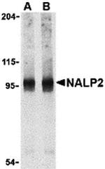 NALP2 Polyclonal Antibody