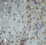 ATF6 Polyclonal Antibody