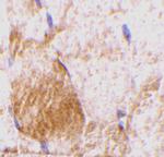 IL-31 Polyclonal Antibody