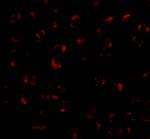 BMI-1 Antibody in Immunocytochemistry (ICC/IF)