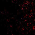 PAK4 Antibody in Immunohistochemistry (IHC)