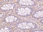 PAK4 Antibody in Immunohistochemistry (IHC)