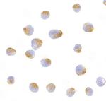 Bcl-B Antibody in Immunocytochemistry (ICC/IF)