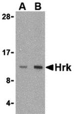 HRK Polyclonal Antibody