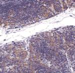 TNFRSF14 Polyclonal Antibody