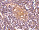 AIM Polyclonal Antibody